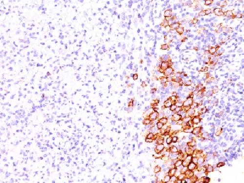 CD30 / TNFRSF8 (Hodgkin & Reed-Sternberg Cell Marker) Antibody
