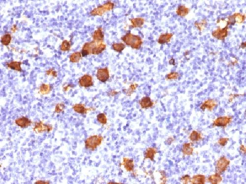 CD30 / TNFRSF8 (Hodgkin & Reed-Sternberg Cell Marker) Antibody