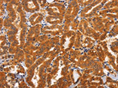 TNFRSF8 Antibody