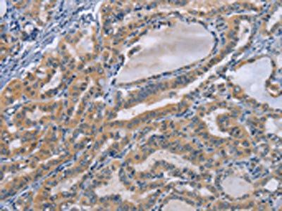 TNFRSF8 Antibody