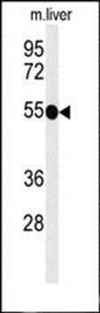 TNFRSF8-Y479 antibody