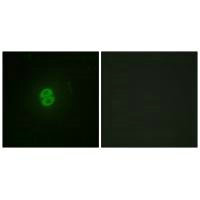 TNFSF10 Antibody
