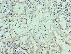 TNFSF12 Antibody