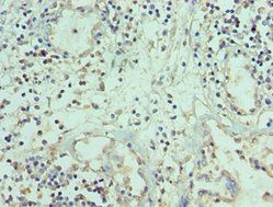 TNFSF12 antibody