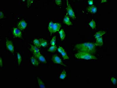 TNFSF12 antibody