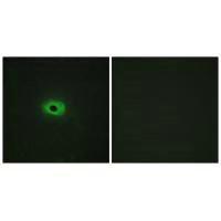 TNFSF12 Antibody