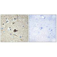 TNFSF12 Antibody