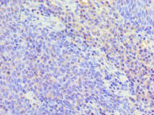 TNFSF13B antibody