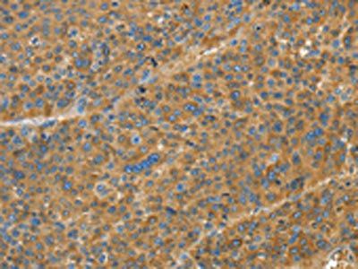 TNFSF13B antibody