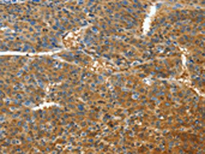 TNFSF13B antibody