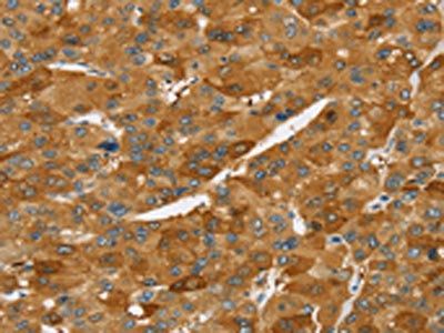 TNFSF15 antibody