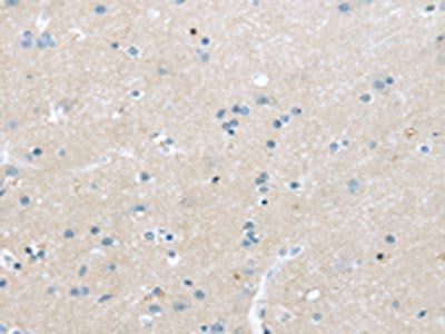 TNFSF4 Antibody