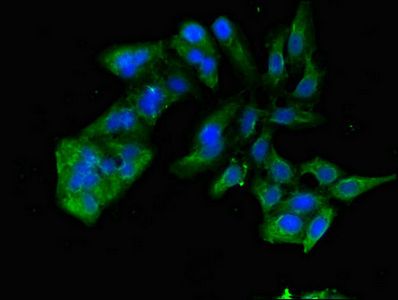 TNIK Antibody