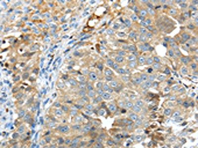 TNIP1 antibody