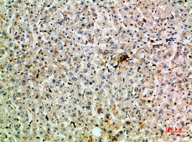 TNIP2 antibody