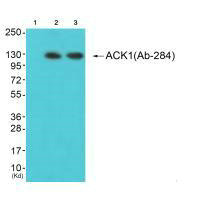 TNK2 (Ab-284) Antibody