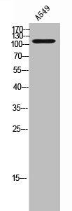 TNK2 Antibody
