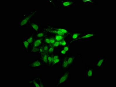 TNKS1BP1 Antibody