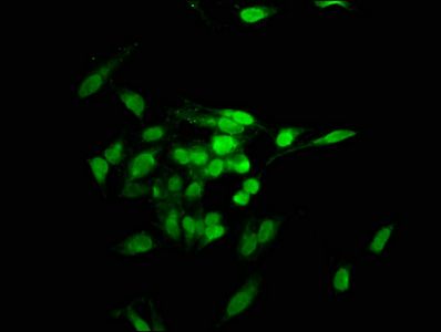 TNKS1BP1 antibody