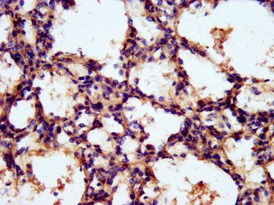 TNKS1BP1 Antibody
