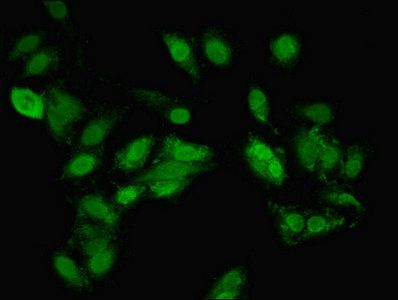 TNKS2 Antibody