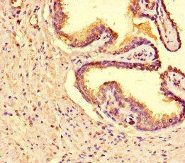 TNKS2 Antibody
