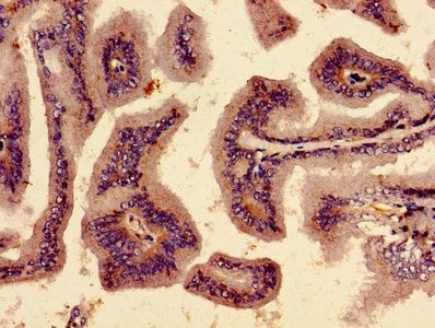 TNKS2 Antibody