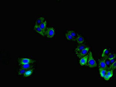 TNMD antibody