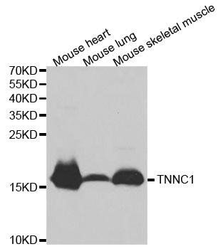 TNNC1 antibody