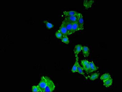 TNNC1 antibody