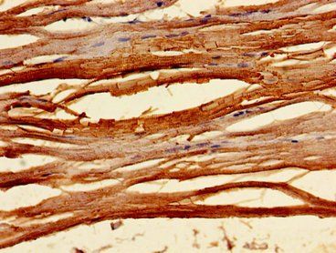TNNC1 Antibody