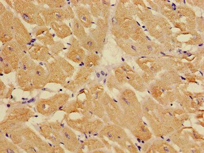 TNNC1 Antibody