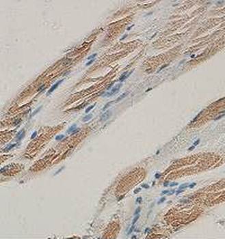TNNI2 Rabbit Polyclonal Antibody