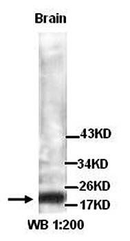 TNNI2 antibody