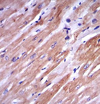 TNNI2 Antibody