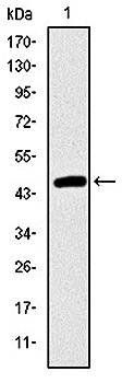 TNNI2 Antibody