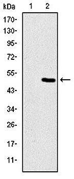 TNNI2 Antibody