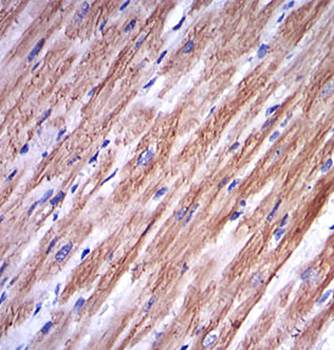 TNNI2 Antibody