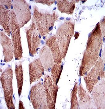 TNNI2 Antibody