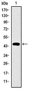 TNNI2 Antibody