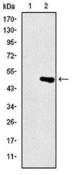 TNNI2 Antibody