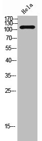 TNNI3 Antibody