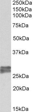Goat anti-TNNI3 (aa117-127) Antibody
