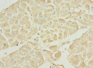 TNNI3K Antibody