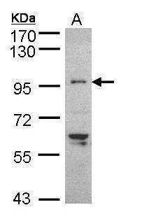 TNNI3K antibody [N2C1], Internal