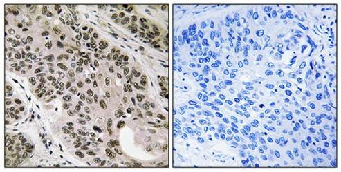 TNNI3K antibody