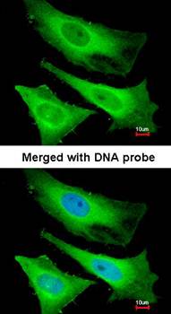 TNNI3K antibody