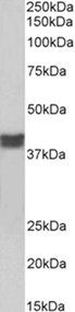 Goat anti-cardiac troponin T Antibody