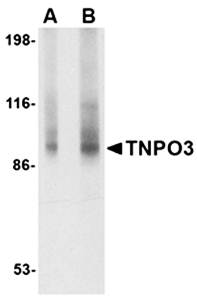 TNPO3 Rabbit Polyclonal Antibody