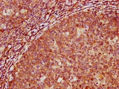 TNR Antibody